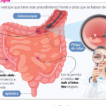 Enteroscopia, procedimiento avanzado y seguro que permite evaluación del intestino delgado