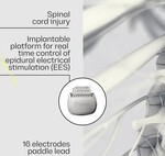 Un "puente digital" entre cerebro y cuerpo: la tecnología pionera para recuperar a pacientes con parálisis