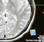 La gente está olvidando lo que le pasó durante la pandemia (porque el trauma se olvida)