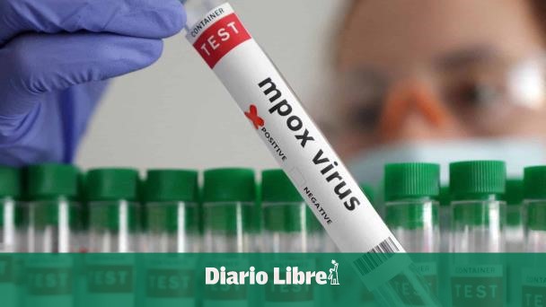 Desde abril no se registran casos de viruela símica en RD