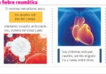 Impacto de la amigdalitis en la salud del corazón