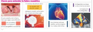 Impacto de la amigdalitis en la salud del corazón