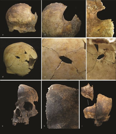 Amputaciones, canibalismo y deshumanización: la matanza más violenta y extrema de la prehistoria sucedió hace 4.000 años