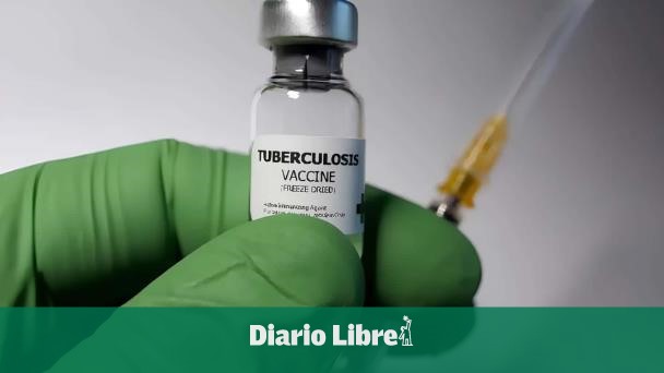 Buscan eficientizar vacuna contra la tuberculosis